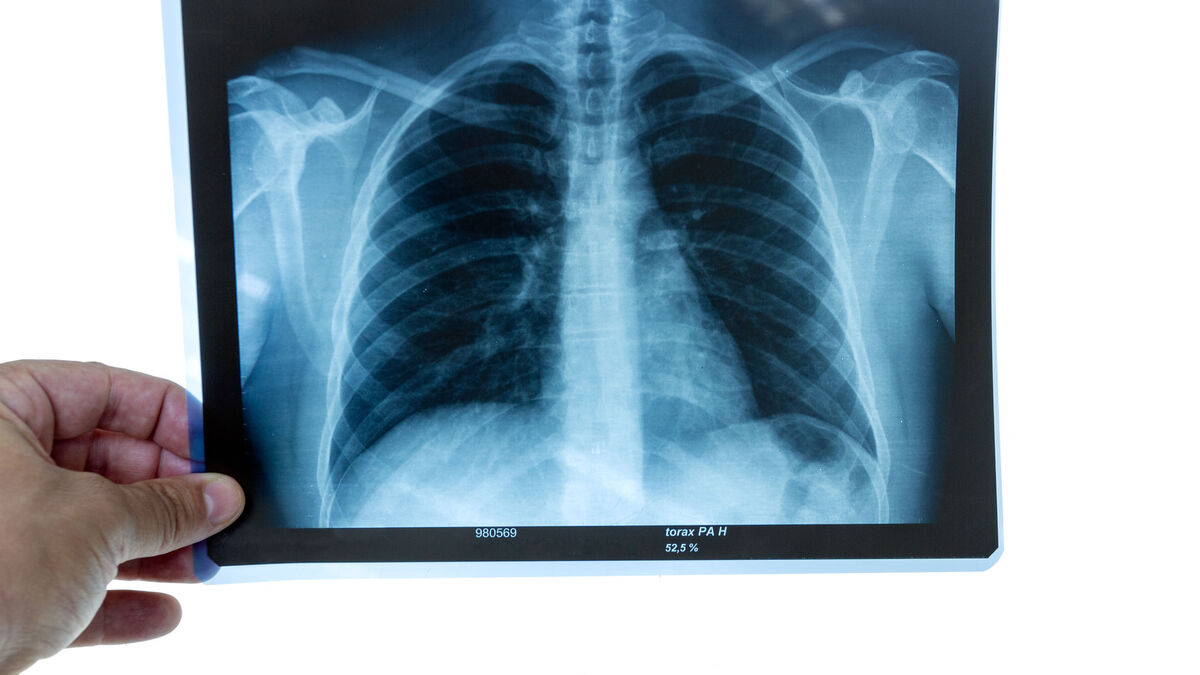 Calls for mobile x-ray to be rolled out quickly in Mayo