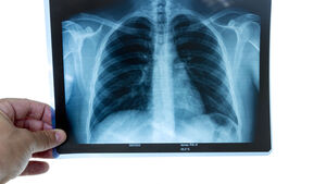 Calls for mobile x-ray to be rolled out quickly in Mayo
