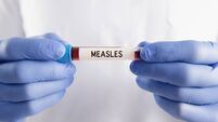 Measles case confirmed in Mayo