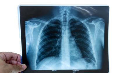 New mobile health service is proving a success in the West