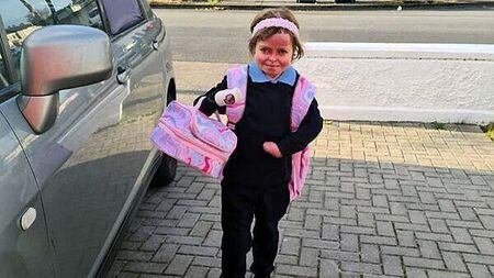 Girl with rare skin disease excited to go to secondary school