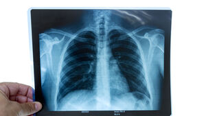 New facility for diagnostic imaging planned for Mayo New facility for diagnostic imaging planned for Mayo