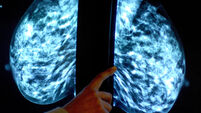Staffing issues impact MUH mammography service