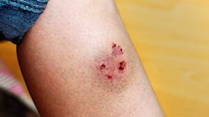 Dog attacks in Mayo are among the highest in country