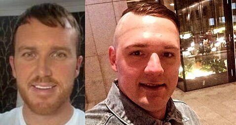 Two men face charges upgrade over 'ferocious' Temple Bar attack