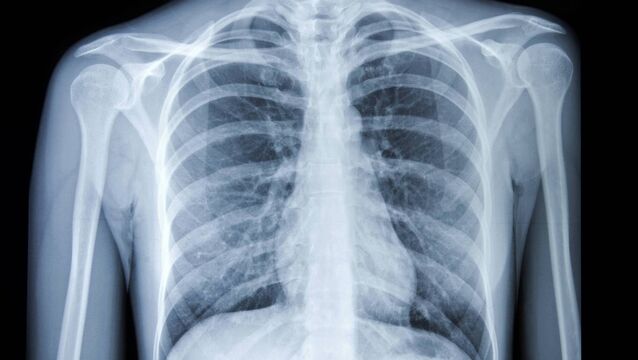 High praise for Mayo's X-ray service