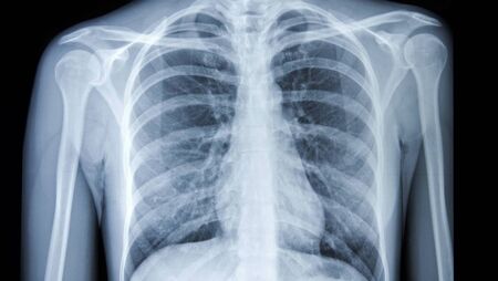 High praise for Mayo's X-ray service